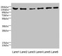 Western blot; All lanes: CD1C antibody at 4.61µg/ml; Lane 1: Mouse brain tissue; Lane 2: Mouse lung tissue; Lane 3: 293T whole cell lysate; Lane 4: HepG2 whole cell lysate; Lane 5: Jurkat whole cell lysate; Lane 6: Hela whole cell lysate; Secondary; Goat polyclonal to rabbit IgG at 1/10000 dilution; Predicted band size: 137, 134, 140 kDa; Observed band size: 137 kDa;