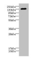 Western blot; All lanes: CACNA2D2 antibody IgG at 4.51µg/ml + Mouse brain tissue; Secondary; Goat polyclonal to rabbit IgG at 1/10000 dilution; Predicted band size: 130, 123, 131 kDa; Observed band size: 130 kDa;