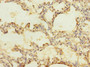Immunohistochemistry of paraffin-embedded human lung tissue using CAC10883 at dilution of 1:100