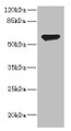 Western blot; All lanes: CHRNA2 antibody at 2.41µg/ml + HL60 whole cell lysate; Secondary; Goat polyclonal to rabbit IgG at 1/10000 dilution; Predicted band size: 60, 59 kDa; Observed band size: 60 kDa