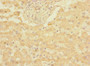 Immunohistochemistry of paraffin-embedded human liver tissue using CAC10885 at dilution of 1:100