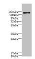 Western blot; All lanes: CR1 antibody at 3.15µg/ml + 293T whole cell lysate; Secondary; Goat polyclonal to rabbit IgG at 1/10000 dilution; Predicted band size: 224 kDa; Observed band size: 224 kDa