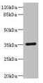 Western blot; All lanes: FCGR2C antibody IgG at 1.67µg/ml + Human Burkitt lymphoma cells; Secondary; Goat polyclonal to rabbit IgG at 1/10000 dilution; Predicted band size: 36, 31, 30, 26 kDa; Observed band size: 36 kDa;