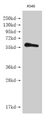 Western blot; All lanes: IFNLR1 antibody at 3.04µg/ml; Lane 1: Mouse kidney tissue; Lane 2: Mouse liver tissue; Lane 3: Human placenta tissue; Lane 4: Mouse lung tissue; Secondary; Goat polyclonal to rabbit IgG at 1/10000 dilution; Predicted band size: 58, 55, 24, 28 kDa; Observed band size: 58 kDa