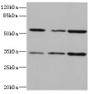 Western blot; All lanes: IL17RB antibody at 2.16µg/ml; Lane 1: 293T whole cell lysate; Lane 2: Hela whole cell lysate; Lane 3: HepG2 whole cell lysate; Secondary; Goat polyclonal to rabbit IgG at 1/10000 dilution; Predicted band size: 56, 32 kDa; Observed band size: 56, 32 kDa