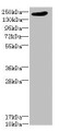 Western blot; All lanes: LRP4 antibody at 1.39µg/ml + PC-3 whole cell lysate; Secondary; Goat polyclonal to rabbit IgG at 1/10000 dilution; Predicted band size: 213 kDa; Observed band size: 213 kDa