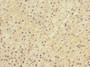 Immunohistochemistry of paraffin-embedded human adrenal gland tissue using CAC10894 at dilution of 1:100