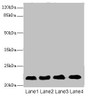 Western blot; All lanes: CRIP2 antibody at 5.93µg/ml; Lane 1: Rat heart tissue; Lane 2: Mouse lung tissue; Lane 3: Hela whole cell lysate; Lane 4: MCF-7 whole cell lysate; Secondary; Goat polyclonal to rabbit IgG at 1/10000 dilution; Predicted band size: 23, 31 kDa; Observed band size: 23 kDa