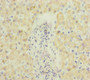 Immunohistochemistry of paraffin-embedded human liver tissue using CAC10922 at dilution of 1:100
