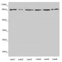 Western blot; All lanes: YME1L1 antibody at 3.8µg/ml; Lane 1: A549 whole cell lysate; Lane 2: Jurkat whole cell lysate; Lane 3: A431 whole cell lysate; Lane 4: Hela whole cell lysate; Lane 5: HepG2 whole cell lysate; Lane 6: MCF-7 whole cell lysate; Secondary; Goat polyclonal to rabbit IgG at 1/10000 dilution; Predicted band size: 87, 80, 76 kDa; Observed band size: 87 kDa