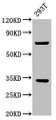 Western Blot; Positive WB detected in: 293T whole cell lysate; All lanes: SLC25A5 antibody at 3.5µg/ml; Secondary; Goat polyclonal to rabbit IgG at 1/50000 dilution; Predicted band size: 33 kDa; Observed band size: 33 kDa;