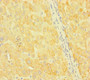 Immunohistochemistry of paraffin-embedded human liver tissue using CAC10949 at dilution of 1:100