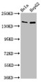 Western Blot; Positive WB detected in: Hela whole cell lysate, HepG2 whole cell lysate; All lanes: SULF1 antibody at 4µg/ml; Secondary; Goat polyclonal to rabbit IgG at 1/50000 dilution; Predicted band size: 102 kDa; Observed band size: 150 kDa;