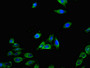 Immunofluorescent analysis of Hela cells using CAC10968 at dilution of 1:100 and Alexa Fluor 488-congugated AffiniPure Goat Anti-Rabbit IgG(H+L)