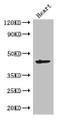 Western Blot; Positive WB detected in: Mouse heart tissue; All lanes: MEI4 antibody at 2.7µg/ml; Secondary; Goat polyclonal to rabbit IgG at 1/50000 dilution; Predicted band size: 45 kDa; Observed band size: 45 kDa;