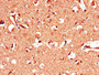 Immunohistochemistry of paraffin-embedded human brain tissue using CAC10977 at dilution of 1:100