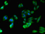 Immunofluorescent analysis of HepG2 cells using CAC10985 at dilution of 1:100 and Alexa Fluor 488-congugated AffiniPure Goat Anti-Rabbit IgG(H+L)