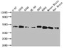 Western Blot; ,Positive WB detected in: Hela whole cell lysate, HepG2 whole cell lysate, Jurkat whole cell lysate, MCF-7 whole cell lysate; ,All lanes: SPPL3 antibody at 3µg/ml; ,Secondary; ,Goat polyclonal to rabbit IgG at 1/50000 dilution; ,Predicted band size: 43, 19 kDa; ,Observed band size: 43 kDa;