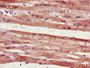 Immunohistochemistry of paraffin-embedded human heart tissue using CAC10988 at dilution of 1:100