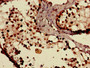 Immunohistochemistry of paraffin-embedded human testis tissue using CAC10989 at dilution of 1:100