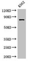 Western Blot; Positive WB detected in: K562 whole cell lysate; All lanes: IL12RB1 antibody at 3.5µg/ml; Secondary; Goat polyclonal to rabbit IgG at 1/50000 dilution; Predicted band size: 74, 73, 43 kDa; Observed band size: 74 kDa