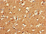 Immunohistochemistry of paraffin-embedded human brain tissue using CAC10996 at dilution of 1:100