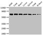 Western Blot; ,Positive WB detected in: A549 whole cell lysate, Rat lung tissue, Mouse heart tissue, Mouse liver tissue, Mouse spleen tissue, Mouse lung tissue, Mouse kidney tissue; ,All lanes: RPA1 antibody at 3.4µg/ml; ,Secondary; ,Goat polyclonal to rabbit IgG at 1/50000 dilution; ,Predicted band size: 69 kDa; ,Observed band size: 69 kDa