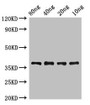 Western Blot; Positive WB detected in Recombinant protein; All lanes: lplA antibody at 2µg/ml; Secondary; Goat polyclonal to rabbit IgG at 1/50000 dilution; predicted band size: 38 kDa; observed band size: 38 kDa;