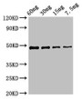 Western Blot; Positive WB detected in Recombinant protein; All lanes: cobB antibody at 2.7µg/ml; Secondary; Goat polyclonal to rabbit IgG at 1/50000 dilution; Predicted band size: 49 kDa; Observed band size: 49 kDa