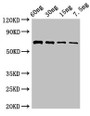 Western Blot; Positive WB detected in Recombinant protein; All lanes: pvdA antibody at 2.8µg/ml; Secondary; Goat polyclonal to rabbit IgG at 1/50000 dilution; Predicted band size: 65 kDa; Observed band size: 65 kDa