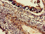 Immunohistochemistry of paraffin-embedded human lung tissue using CAC11047 at dilution of 1:100