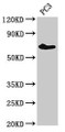 Western Blot; Positive WB detected in: PC-3 whole cell lysate; All lanes: ICK antibody at 3µg/ml; Secondary; Goat polyclonal to rabbit IgG at 1/50000 dilution; Predicted band size: 72, 35 kDa; Observed band size: 72 kDa;