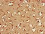 Immunohistochemistry of paraffin-embedded human brain tissue using CAC11060 at dilution of 1:100