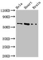 Western Blot; , Positive WB detected in: Hela whole cell lysate, Mouse heart tissue, Mouse brain tissue; , All lanes: BAIAP2 antibody at 3.2µg/ml; , Secondary; , Goat polyclonal to rabbit IgG at 1/50000 dilution; , Predicted band size: 61, 60, 57, 58 kDa; , Observed band size: 61 kDa
