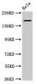 Western Blot; Positive WB detected in: Hela whole cell lysate; All lanes: ROBO1 antibody at 3.2µg/ml; Secondary; Goat polyclonal to rabbit IgG at 1/50000 dilution; Predicted band size: 181, 182, 177, 176, 170 kDa; Observed band size: 181 kDa