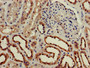 Immunohistochemistry of paraffin-embedded human kidney tissue using CAC11062 at dilution of 1:100