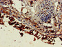 Immunohistochemistry of paraffin-embedded human lung tissue using CAC11063 at dilution of 1:100