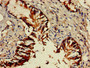 Immunohistochemistry of paraffin-embedded human lung tissue using CAC11064 at dilution of 1:100