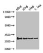 Western Blot; Positive WB detected in Recombinant protein; All lanes: Lysozyme C-1 antibody at 2µg/ml; Secondary; Goat polyclonal to rabbit IgG at 1/50000 dilution; Predicted band size: 30 kDa; Observed band size: 30 kDa
