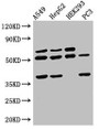 Western Blot; Positive WB detected in: A549 whole cell lysate, HepG2 whole cell lysate, HEK293 whole cell lysate, PC-3 whole cell lysate; All lanes: TAF1A antibody at 2.5µg/ml; Secondary; Goat polyclonal to rabbit IgG at 1/50000 dilution; Predicted band size: 53, 40 kDa; Observed band size: 53, 40 kDa