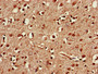 Immunohistochemistry of paraffin-embedded human brain tissue using CAC11087 at dilution of 1:100