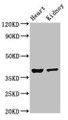 Western Blot; ,Positive WB detected in: Mouse heart tissue, Mouse kidney tissue; ,All lanes: NEUROD1 antibody at 4µg/ml; ,Secondary; ,Goat polyclonal to rabbit IgG at 1/50000 dilution; ,Predicted band size: 40 kDa; ,Observed band size: 40 kDa;