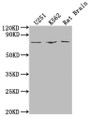 Western Blot; , Positive WB detected in: U251 whole cell lysate, K562 whole cell lysate, Rat Brain tissue; , All lanes: SGO1 antibody at 1:2000; , Secondary; , Goat polyclonal to rabbit IgG at 1/50000 dilution; , Predicted band size: 65, 36, 34, 32, 30, 61, 25 kDa; , Observed band size: 65 kDa;