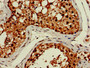 Immunohistochemistry of paraffin-embedded human testis tissue using CAC11099 at dilution of 1:100