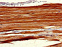 Immunohistochemistry of paraffin-embedded human skeletal muscle tissue using CAC11099 at dilution of 1:100