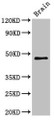 Western Blot; ,Positive WB detected in: Mouse brain tissue; ,All lanes: VMP1 antibody at 3µg/ml; ,Secondary; ,Goat polyclonal to rabbit IgG at 1/50000 dilution; ,Predicted band size: 47, 25 kDa; ,Observed band size: 47 kDa;