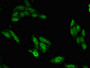 Immunofluorescent analysis of Hela cells using CAC11104 at dilution of 1:100 and Alexa Fluor 488-congugated AffiniPure Goat Anti-Rabbit IgG(H+L)