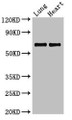 Western Blot; ,Positive WB detected in: Rat lung tissue, Rat heart tissue; ,All lanes: POLL antibody at 2.4µg/ml; ,Secondary; ,Goat polyclonal to rabbit IgG at 1/50000 dilution; ,Predicted band size: 64, 34 kDa; ,Observed band size: 64 kDa;