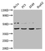 Western Blot; ,Positive WB detected in: Hela whole cell lysate, PC-3 whole cell lysate, A549 whole cell lysate, HepG2 whole cell lysate; ,All lanes: DUX4 antibody at 1:2000; ,Secondary; ,Goat polyclonal to rabbit IgG at 1/50000 dilution; ,Predicted band size: 45 kDa; ,Observed band size: 45 kDa;