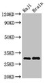 Western Blot; Positive WB detected in: Raji whole cell lysate, Mouse brain tissue; All lanes: HLA-DRB3 antibody at 3.5µg/ml; Secondary; Goat polyclonal to rabbit IgG at 1/50000 dilution; Predicted band size: 30 kDa; Observed band size: 30 kDa